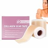 2pcs Silicone Scar Tape,Face Collagens Scar Tape,Silicone Care Patch Scars Tapes,Silicones Anti-Wrinkles Facial Sheets,Smooths Fine Lines,Extra-Large 59-Inch Roll,for All Skin Types