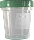 Medi-Inn Urinbecher mit Schraubdeckel grün | 25 Stück | auslaufsicher & gefriertauglich | 125 ml Fassungsvermögen bis 100 ml graduiert | mattiertes Schriftfeld