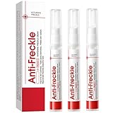 Pigmentflecken Entferner Gesicht, Anti Pigmentflecken Gesicht, Aufhellungscreme, Creme gegen Pigmentfleckens, Melasma und Altersflecken Entfernen, Creme testsieger (3)