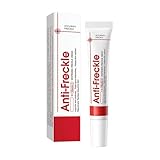 Whitening Freckle Cream, Pigmentflecken Entferner Gesicht, Aufhellungscreme Gegen Dunkle Flecken, Creme gegen Pigmentflecken, Altersflecken Entfernen, Sommersprossen (1)
