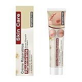 Narbensalbe,Narbencreme,Narbengel,Anwendbar auf Körper Wund- und Heilsalbe,Narbensalbe Nach op,20g