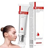 25g Akne Gel , Bekämpft wirksam Pickel und Mitesser bei Akne,Reduziert Hautunreinheiten,Leicht auftragbar, schnell einziehend, nicht fettend