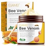Bienengiftcreme Wird Zur Entfernung Von HautanhäNgseln, Warzen Und Muttermalen Verwendet, Bienengift FüR Arme, Taille, FüßE Und Beine, Schmerzfrei – Sanft Zur Haut 120 G