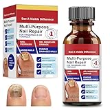 30 ml Nagelhärter Nagelaufbauserum Nail Repair, Schützender Nagelhärter,Nagelhärter fur Brüchige Nägel, Fuß Flüssigkeit für Fingernägel und Fußnägel Nagelpflege