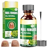 30ML Fußnägel pflegend,Nagelpflege,Schutz & Stärkung brüchiger Nägel,Spendet Feuchtigkeit trockener Nagelhaut,Splitternde & Weiche Nägel Starke Nägel Einfach & Schnell