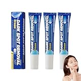 3 Stück Intensive Fleckenentfernungscreme, Feuchtigkeitsspendende Gesichtscreme, mild für sensible Haut, reduziert Dunkelheit & verleiht strahlende, weiße Haut