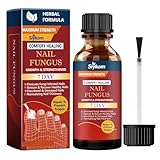 Nagelpilz Nagellack, Nagellack gegen Nagelpilz für Fingernägel und Fußnägel, Schutz & Stärkung Brüchiger Nägel, Spendet Feuchtigkeit Trockener Nagelhaut, 30ml