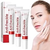 3 PCS Creme Gegen Pigmentflecken Whitening Cream Aufhellungscreme Altersflecken Entfernen Cremes Zum Entfernen Dunkler Flecken Im Gesicht Hellt die Haut Auf Geeignet für Alle Hauttypen