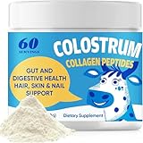 Colostrum Pulver, Natürliche Immununterstützung mit Mineralien & Probiotika, 100% Rein Für Erwachsene & Kinder, 60% Natural IgG Weidemilch-Kolostrum